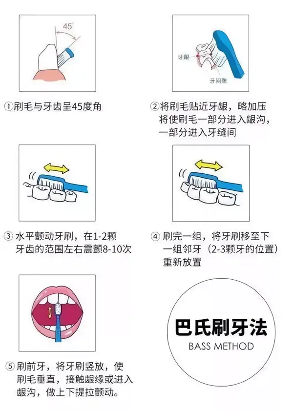 教会孩子使用正确的刷牙方法—— 巴氏刷牙法