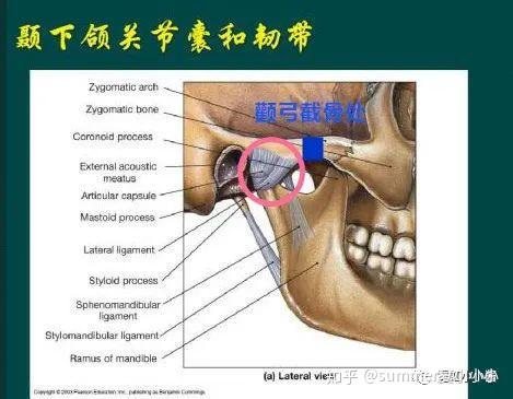 ▽下颌骨髁突宽颧弓根部被韧带和关节囊覆盖的底下,紧贴颧弓下方,差不