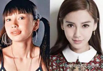 在跑男一路走红的angelababy,被怀疑整过容,为了澄清自己,杨颖做了