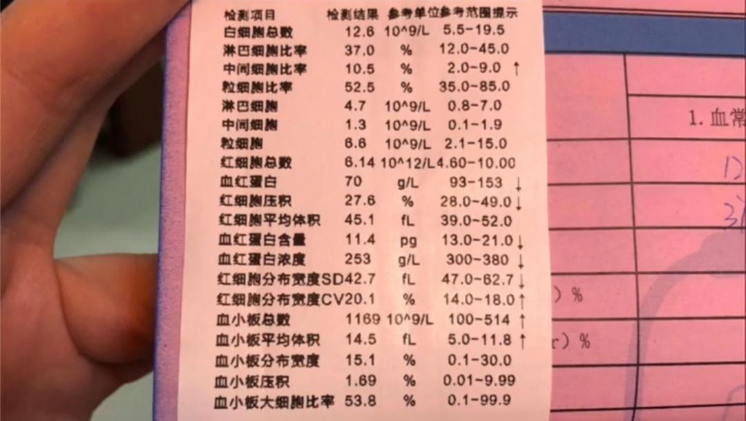 宠物血常规检查各类指标的作用和意义狗猫血常规体检能查出哪些疾病