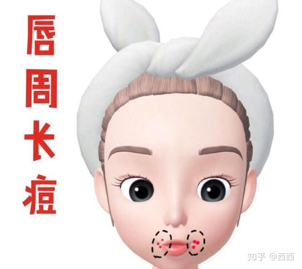 为什么嘴巴周围爱长痘