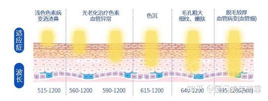 厦门光子嫩肤关于超光子aopt你该了解的那些事儿