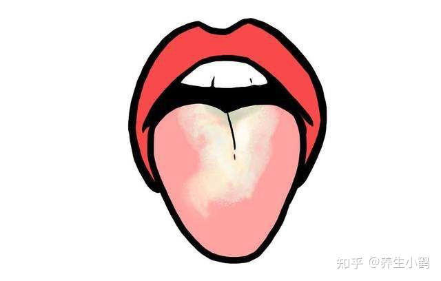 中医科普间如何从舌苔分辨一个人的健康状况