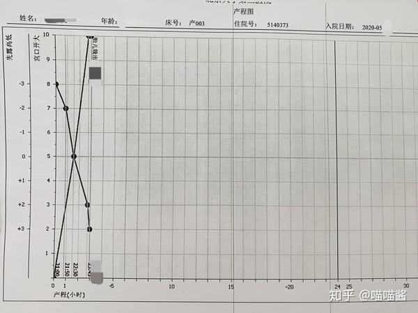 后来复印病历看到的产程图