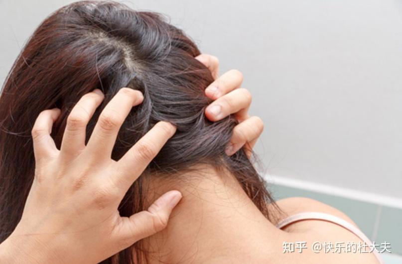 头皮刺痛 zhuanlan.zhihu.com