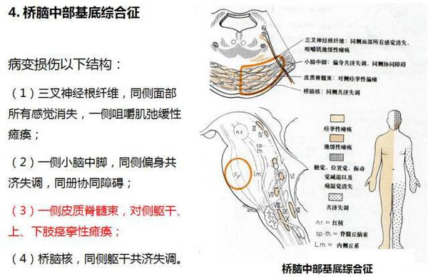 神经系统疾病定位诊断学