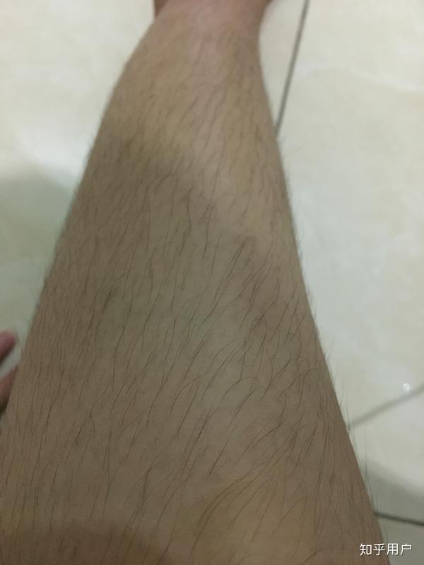 女生体毛多会有男生接受吗?