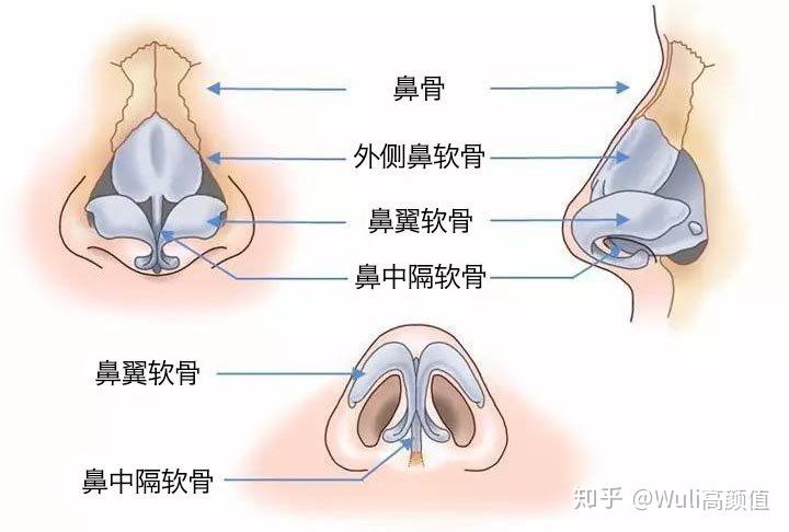 朝天鼻的救星鼻中隔延长