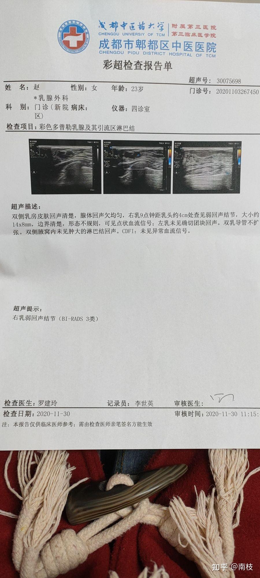 乳腺治疗记录我的乳腺纤维瘤变小了