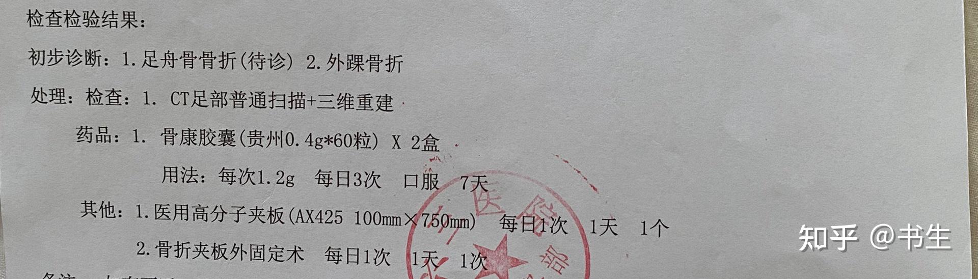 右脚外踝腓骨远端撕脱性骨折