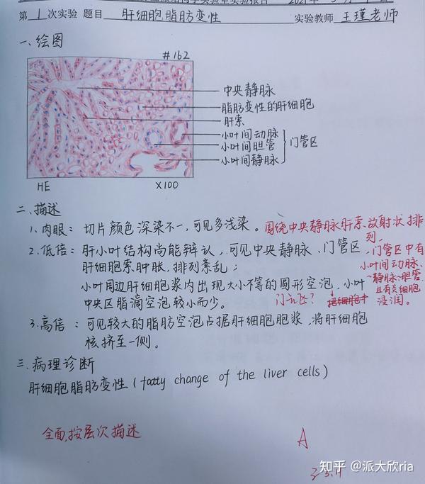 第一章:肝细胞脂肪变性 第二章:损伤的修复 肉芽组织 第三章:局部血液