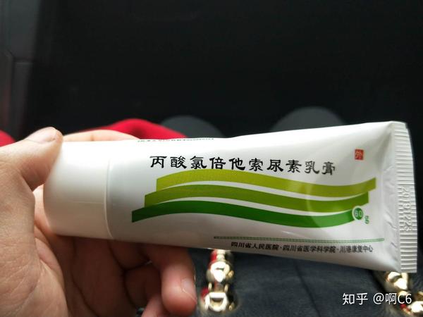 重症银屑病缓解用药推荐给大家