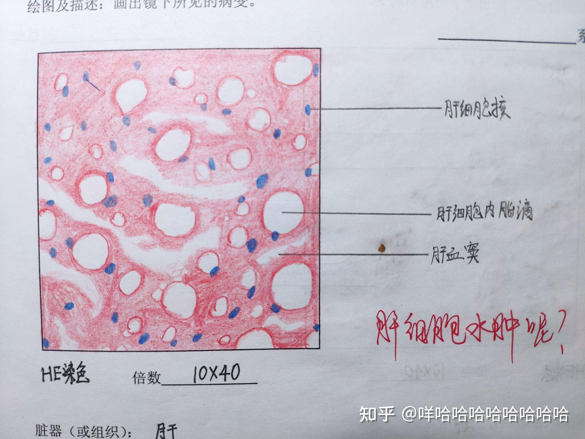 病理学红蓝铅笔图