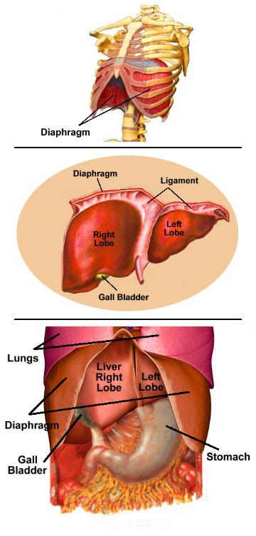 膈疝 diaphragmatic hernia