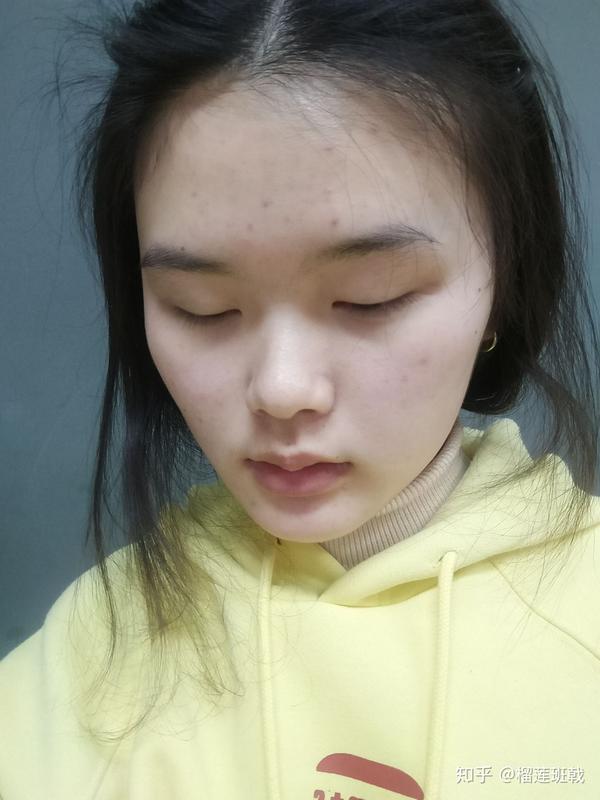 为什么好多单眼皮女孩要割双眼皮?