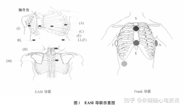 1.       通道双极导联 起搏通道