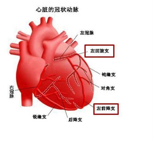 辟谣心脏ct检查左前降支狭窄95支架医生要看具体情况