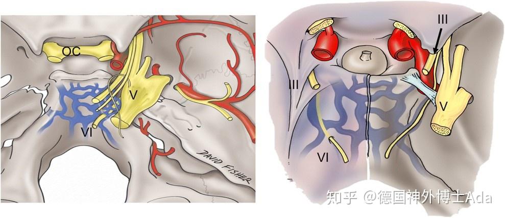 内侧至斜坡中线,外侧至第Ⅶ和Ⅷ脑神经,上缘为鞍背,下缘为颈静脉孔