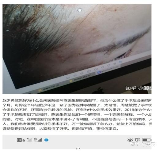 刘华的鼓动和挑拨之下到陈医生来闹事,因为鼻子上根本看不到任何疤痕