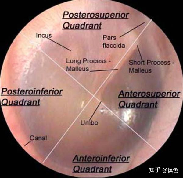 中耳(middle ear)的解剖之鼓室(tympanic cavity)