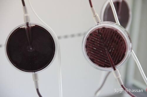 血液过滤器