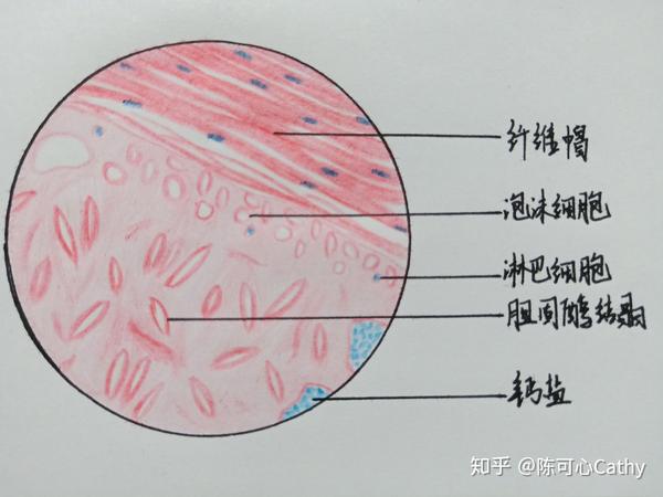 病理学红蓝铅笔绘图实验作业