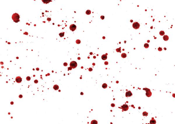 投射性血迹:喷溅血,溅落血,抛甩血等 国内比较有代表性的,也是较为