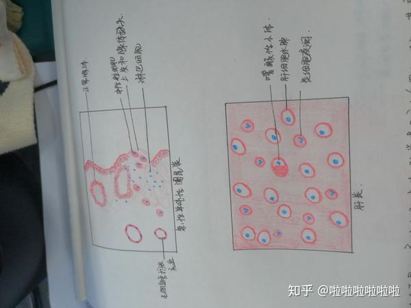 病理学切片红蓝铅笔画