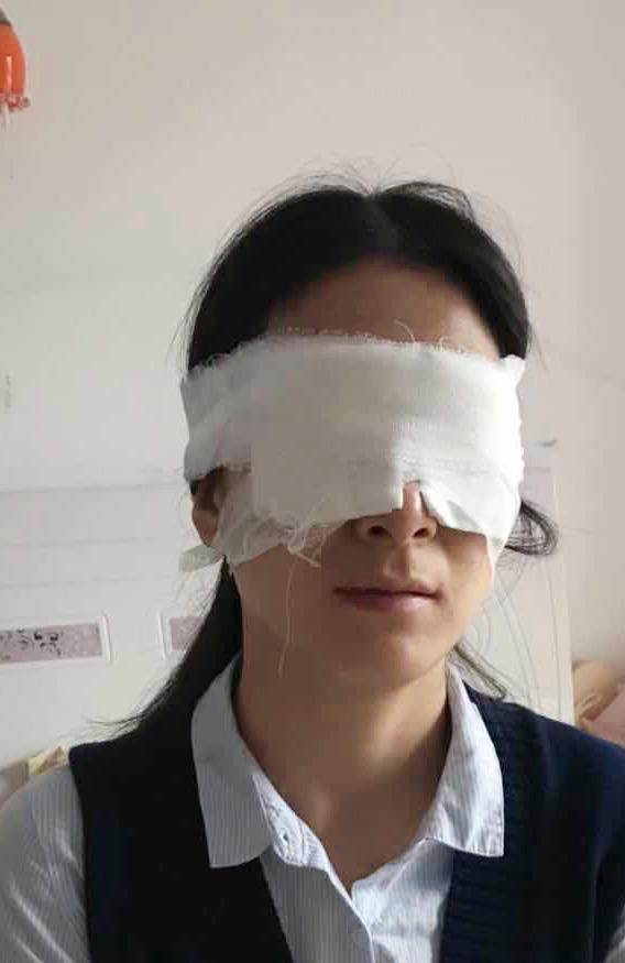 地点:上海第九人民医院 手术类型:全切 费用:4800 由于昨日纱布蒙眼