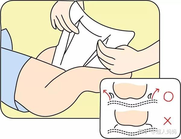 如何给宝宝换纸尿裤?图解纸尿裤正确穿法