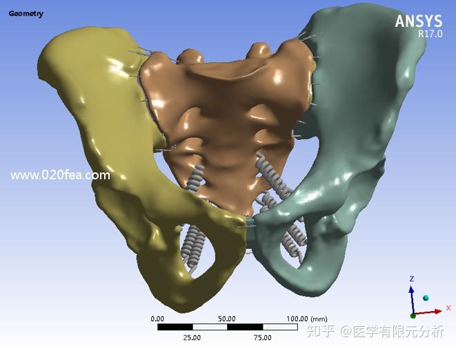 有限元分析在医学领域三维人体建模方面原来可以这么做