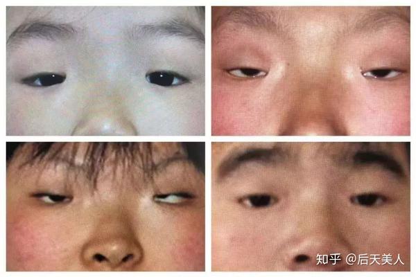 眼睛这里不能动,不然后果很严重?
