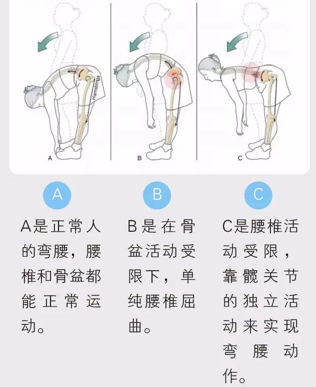 内附练习视频 关于髋关节屈曲灵活性老师这么说 知乎