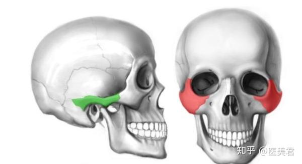 让我们先来认识一下面部颧骨结构(见下图))主要分为 颧骨区和颧弓区