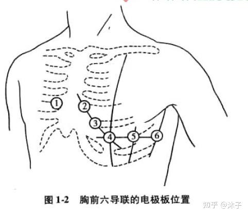 心电图之12导联介绍整理