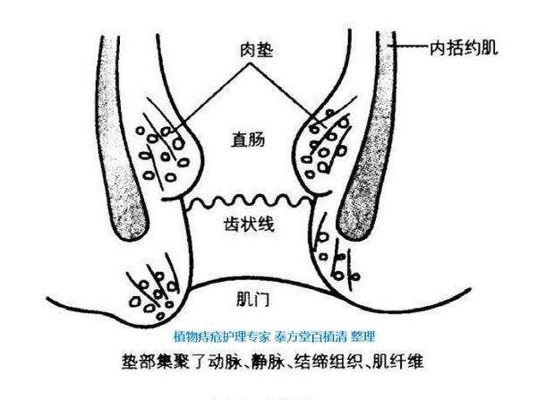 痔疮肛裂肛瘘痔疮到底咋回事图示告诉你收藏转发