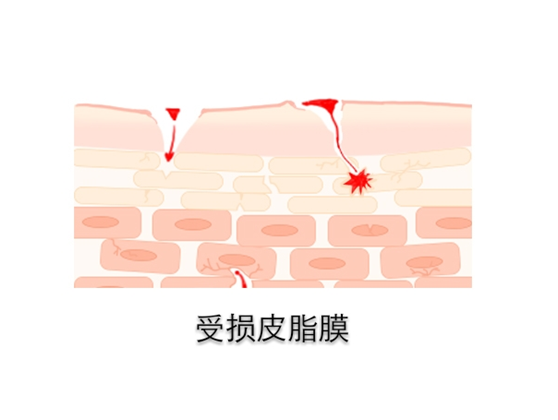 所以皮脂膜其实是皮肤最表层