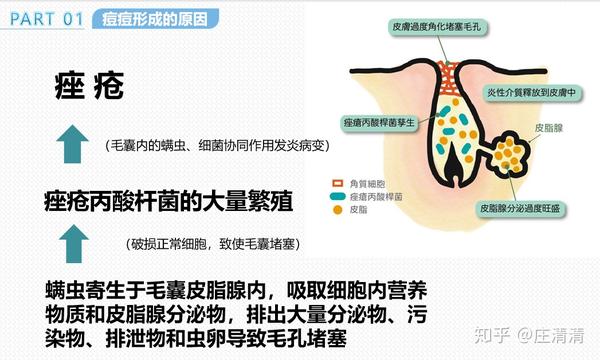 这里我们来了解一下痘痘形成的有关细菌 痤疮丙酸杆菌