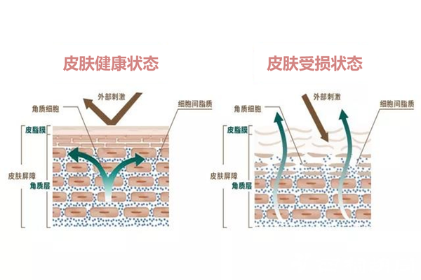 皮肤的第一道屏障是皮脂膜,全部由油脂组成.