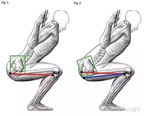 即深蹲时,底盆骨不由自主的做了一个盆骨后倾的动作