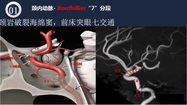 【深度学习】高清头颈动脉系统解剖