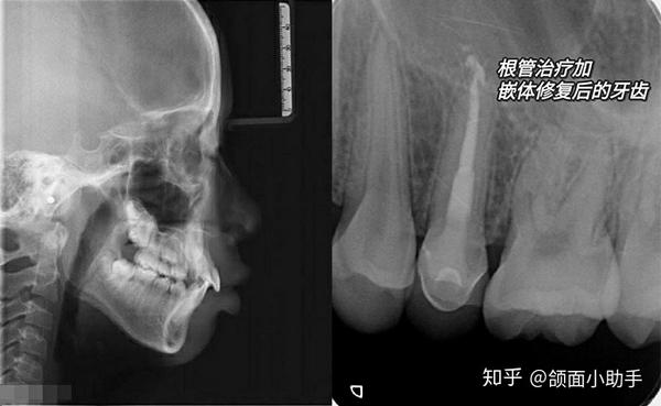 4,口腔ct 这个有些高级了,一般门诊没有,只有专业的口腔医院才有