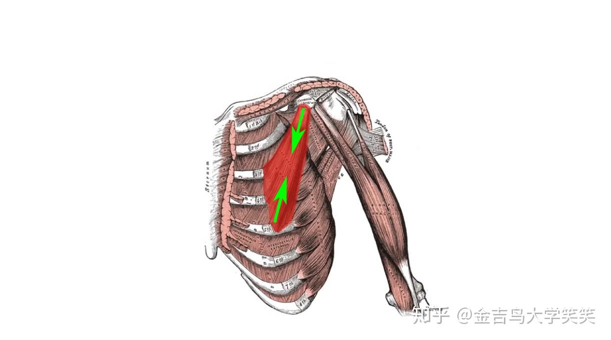 一 胸小肌(pectoralis minor)