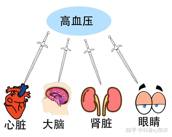 高血压未经药物控制,后续则会出现心脏长大,心脏肥厚,高血压性心脏病