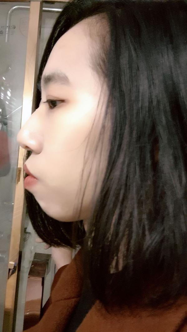 鼻子高但是山根低是什么样?