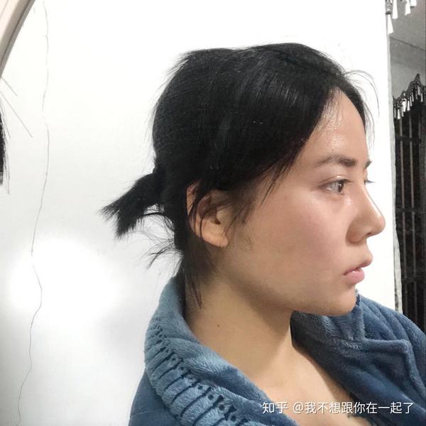 扁头星人的我头不仅扁还大正面又很宽有图