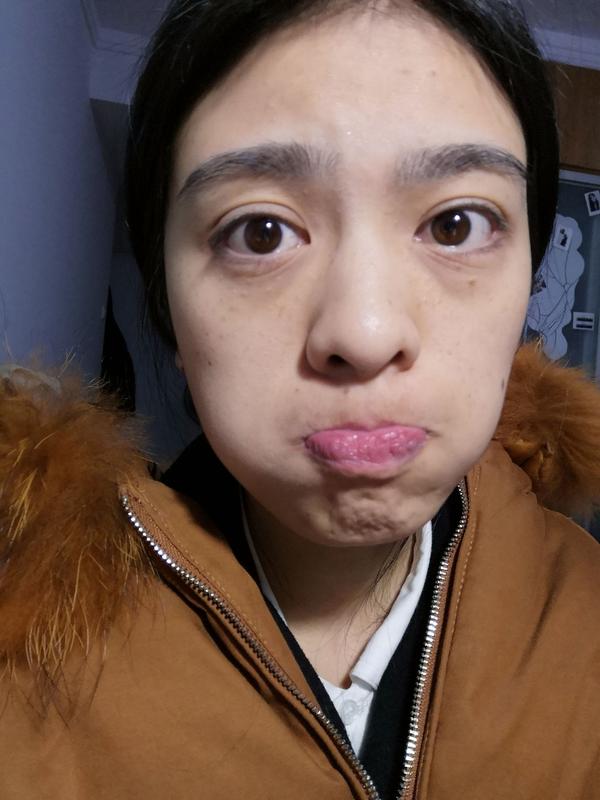 怎么看待五官漂亮但是皮肤差的女性?