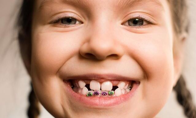 儿童牙齿矫正四大误区,家长要当心