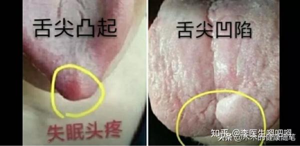 伊能静,脑袋和舌头上都有个坑