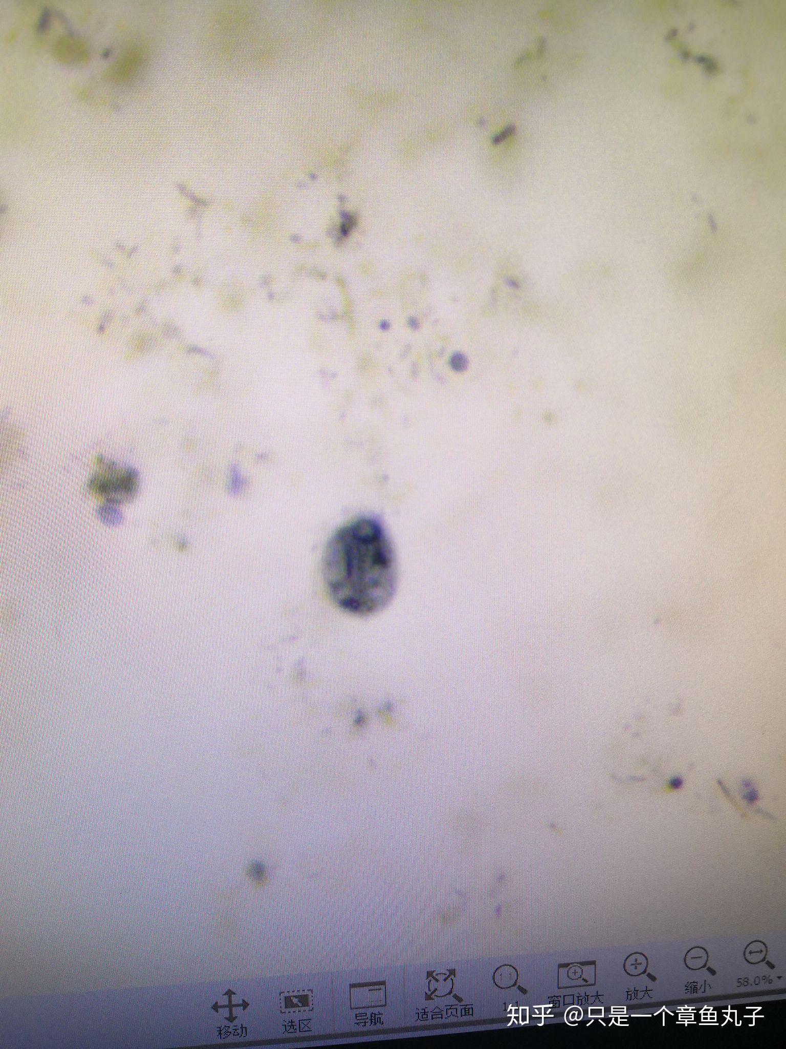 寄生虫部分显微镜下图